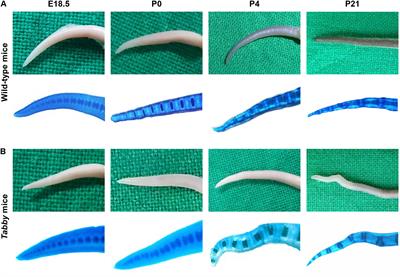 Correction of Vertebral Bone Development in Ectodysplasin A1-Deficient Mice by Prenatal Treatment With a Replacement Protein